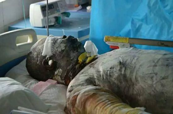 南阳三入火海救人英雄王锋经抢救无效病逝(图